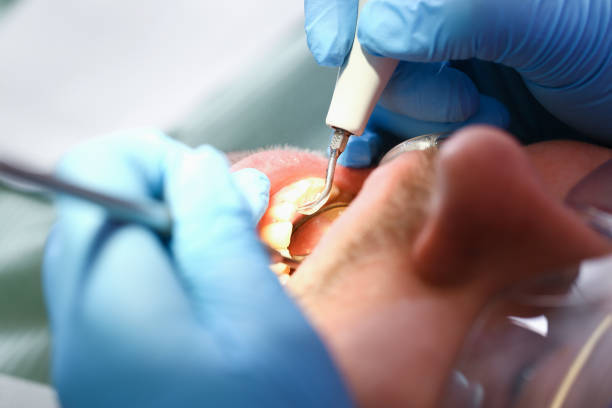 Best Emergency Treatment for Dental Infections or Abscesses in Douglas, MI