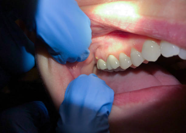 Best Emergency Gum Treatment in Douglas, MI